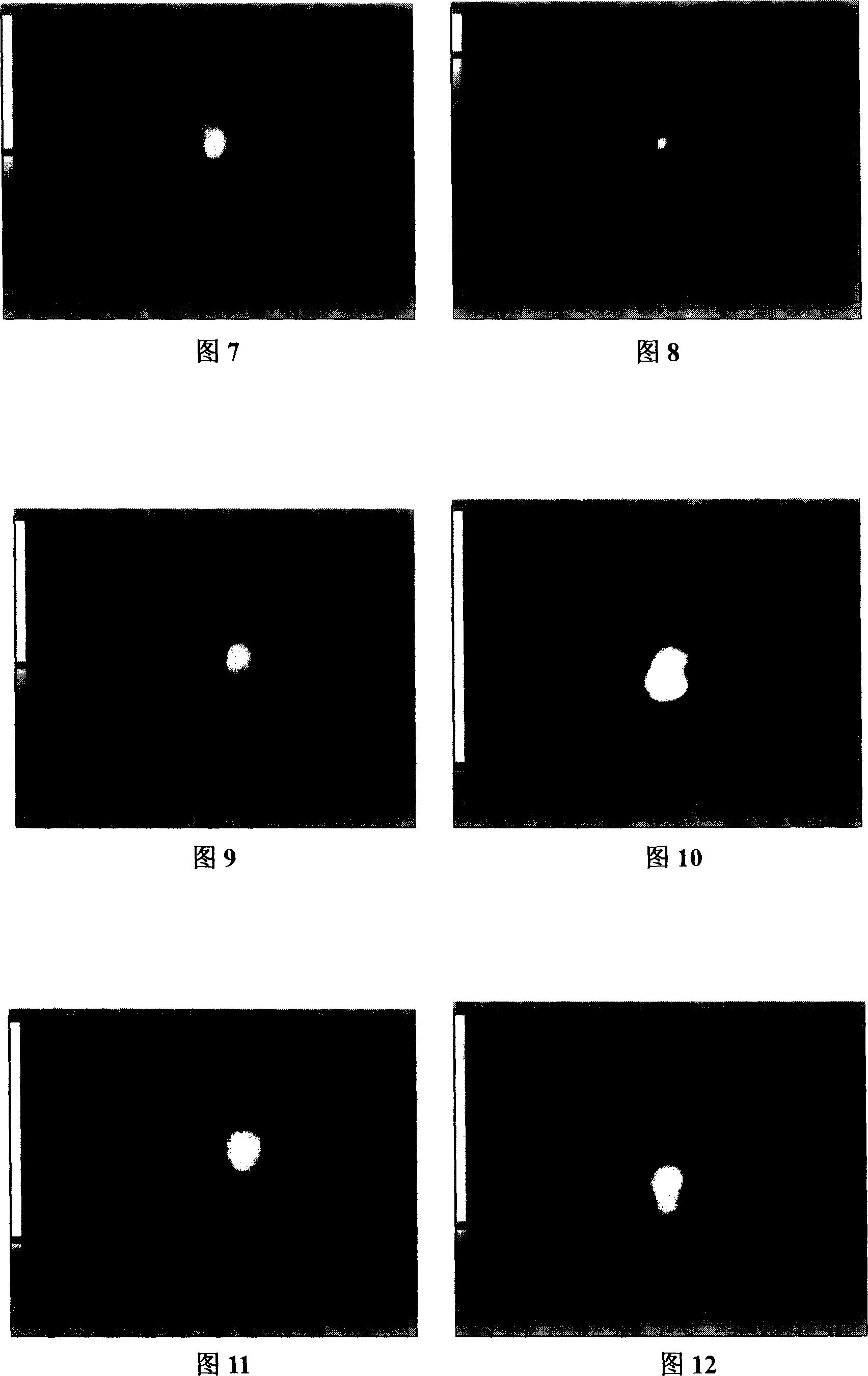 Technetium-99m signed dimercaptosuccinate complexes, preparing method and application thereof