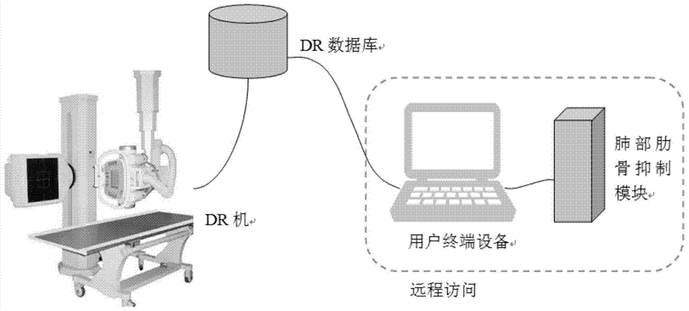 An Image Processing Method for Rib Suppression in Chest X-ray DR Image