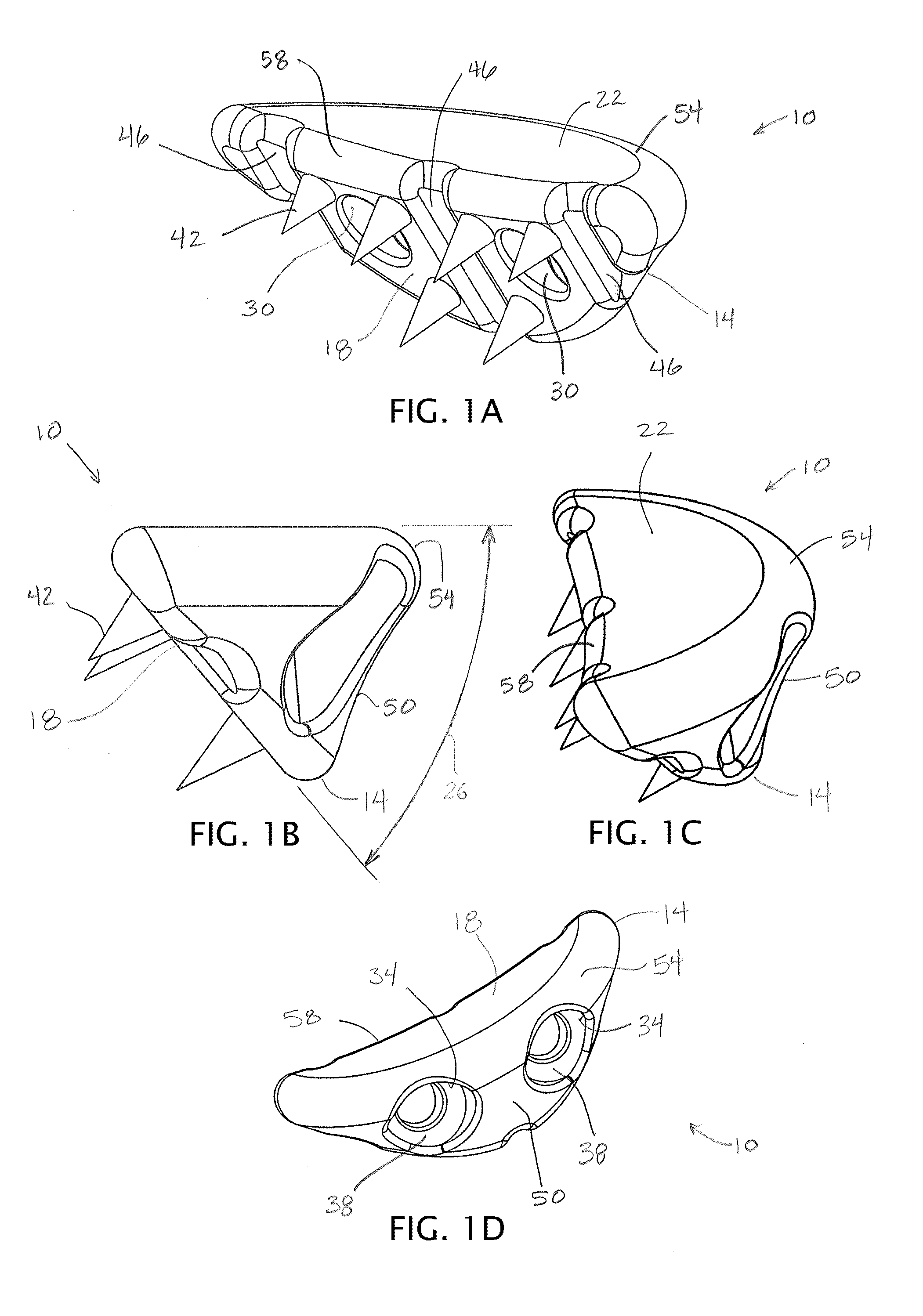 Devices, Apparatuses, Kits, and Methods for Repair of Articular Surface and/or Articular Rim