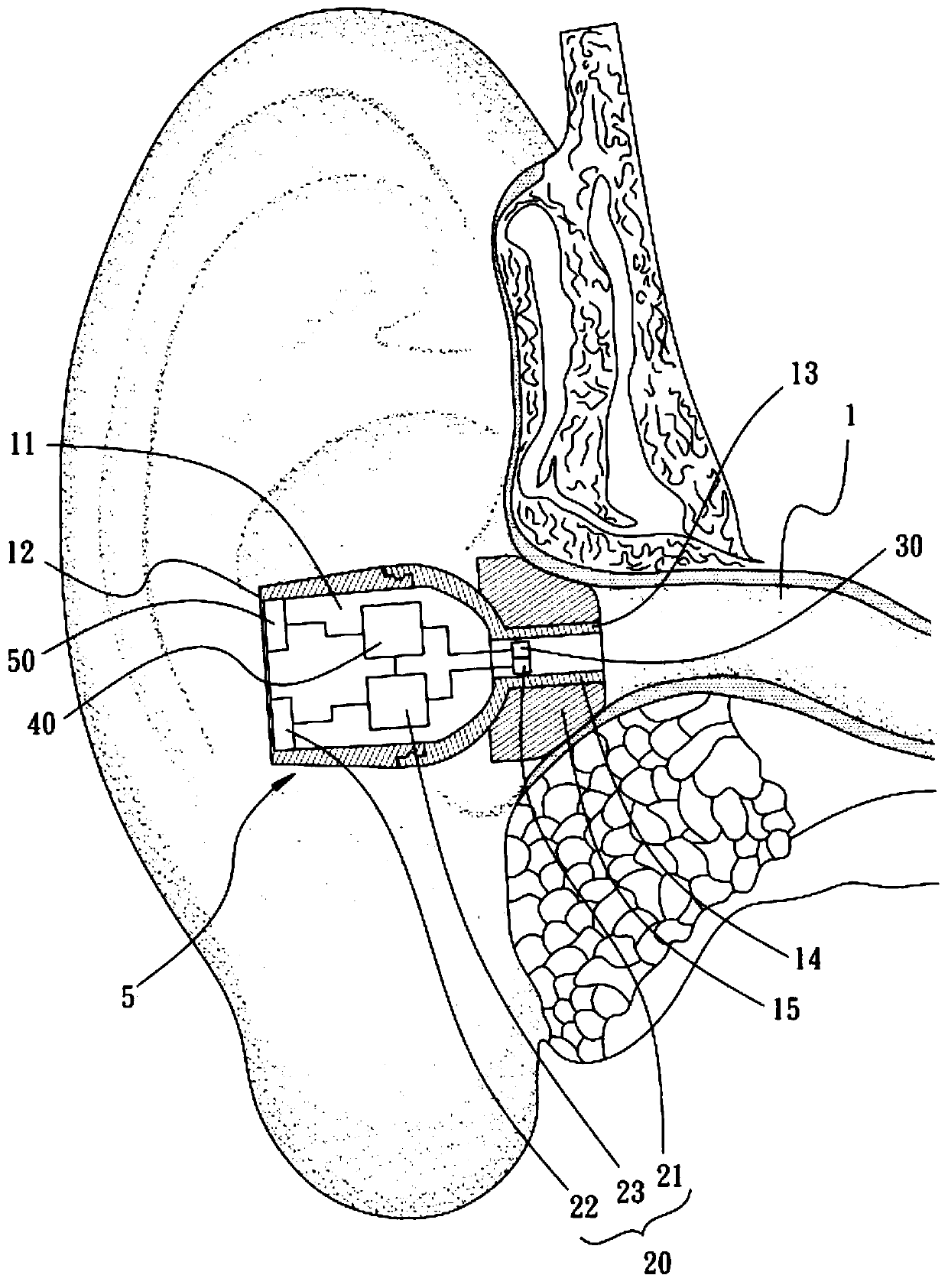 In-ear voice device