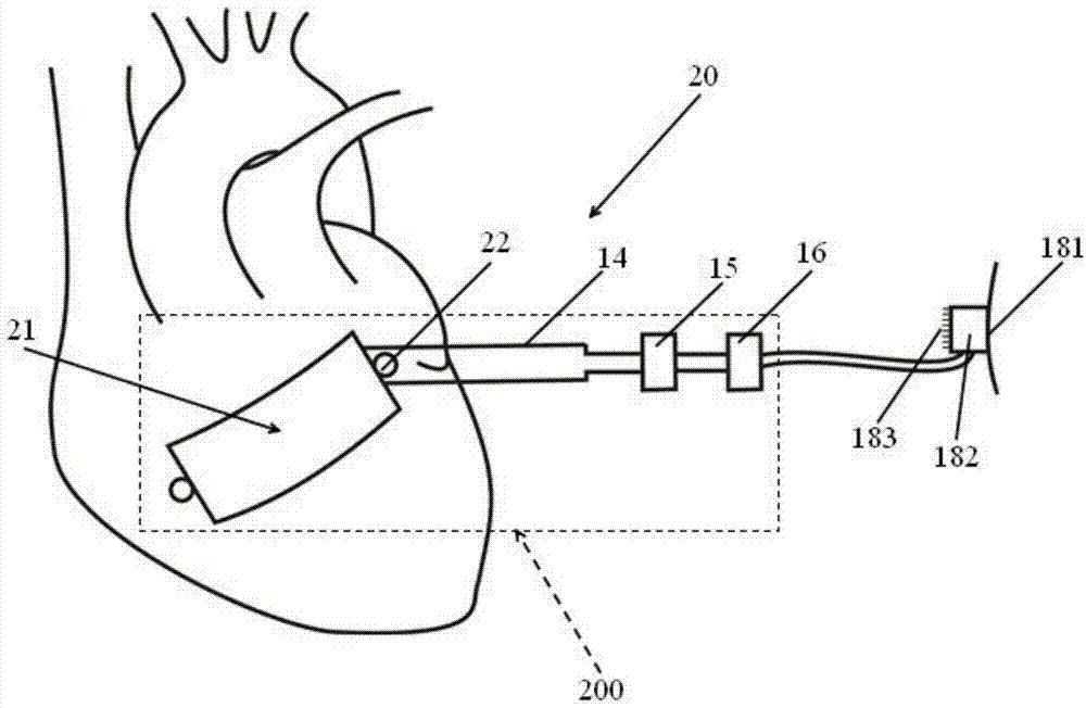 Self-powered electronic retina