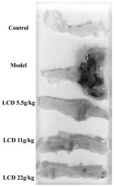 Application of intestine-regulating decoction to preparation of medicine for treating Crohn's disease