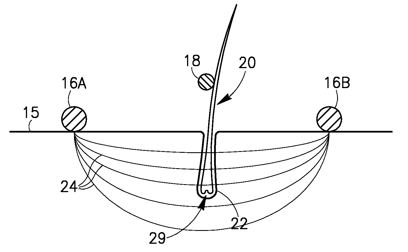 Methods, devices and systems for hair removal