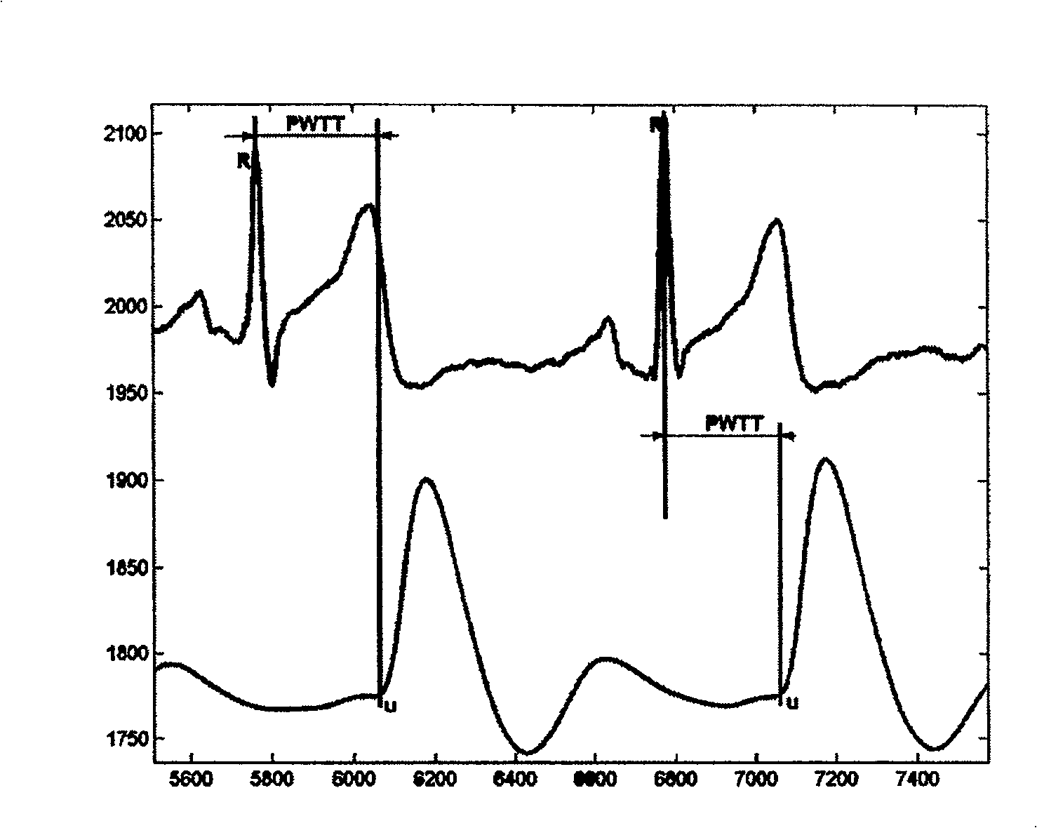 Method and apparatus for obtaining sphygmus wave conducting time in continuously measuring artery blood pressure by sphygmus wave method