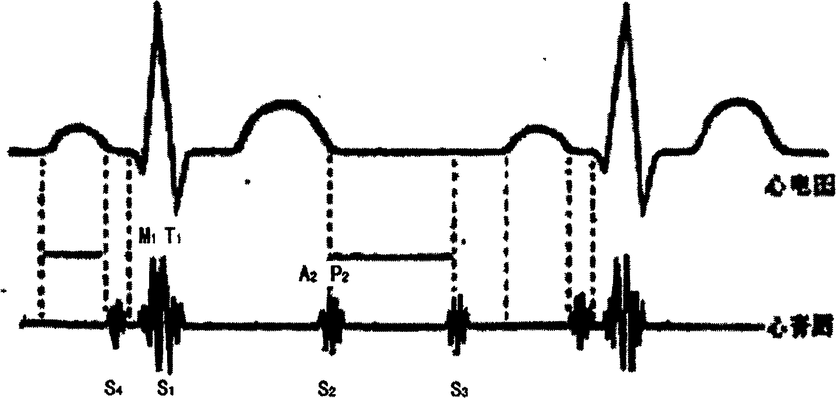 Method and apparatus for obtaining sphygmus wave conducting time in continuously measuring artery blood pressure by sphygmus wave method