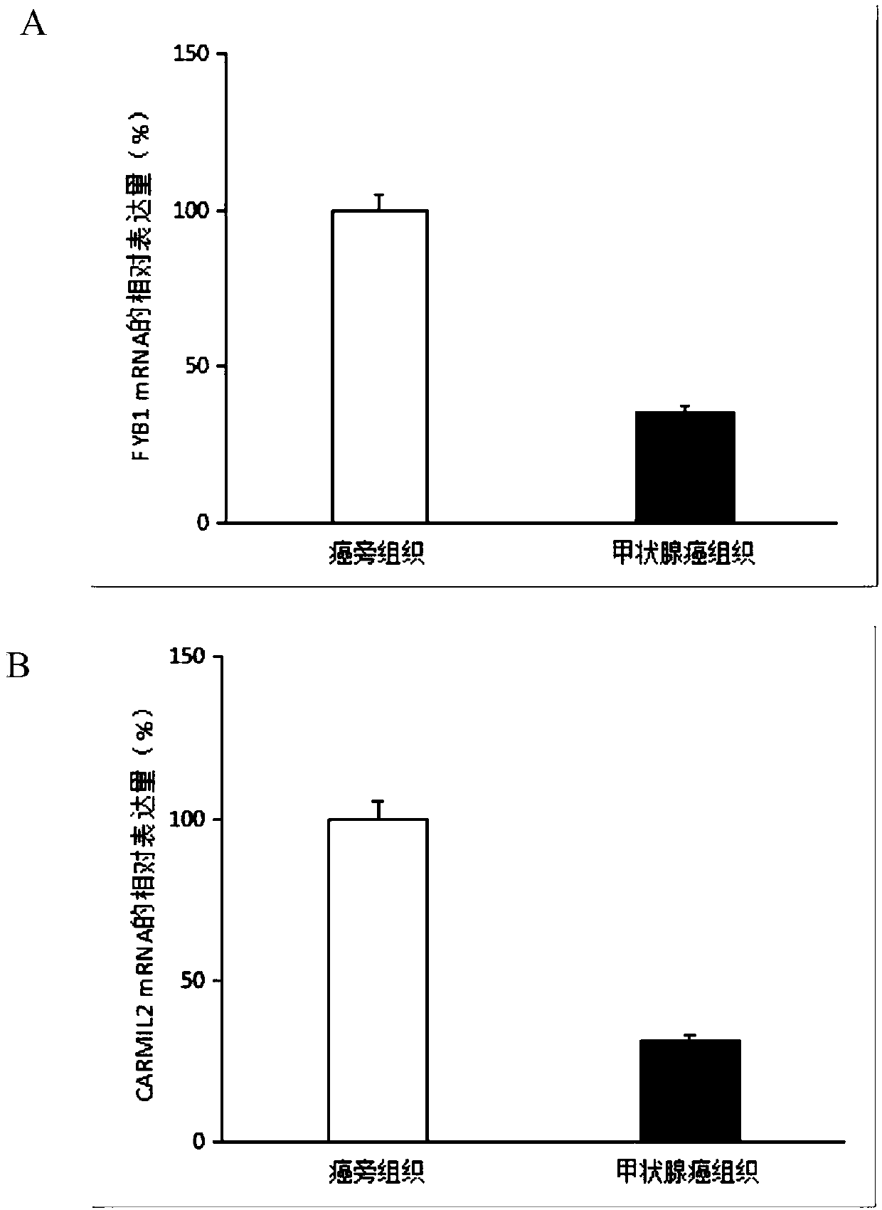 Molecular markers for early detection of thyroid cancer and application of molecular markers