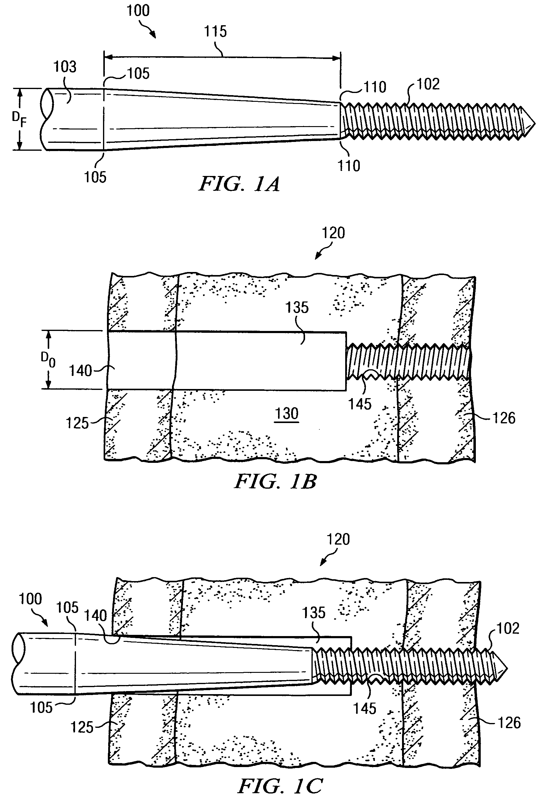 Engaging predetermined radial preloads in securing an orthopedic fastener