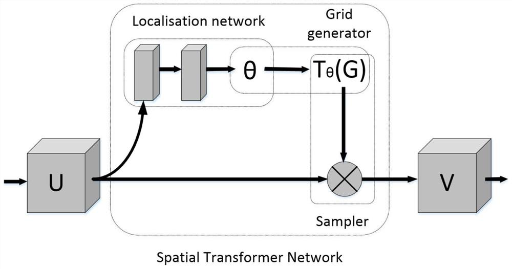 STN-based autism brain magnetic resonance image visualization method