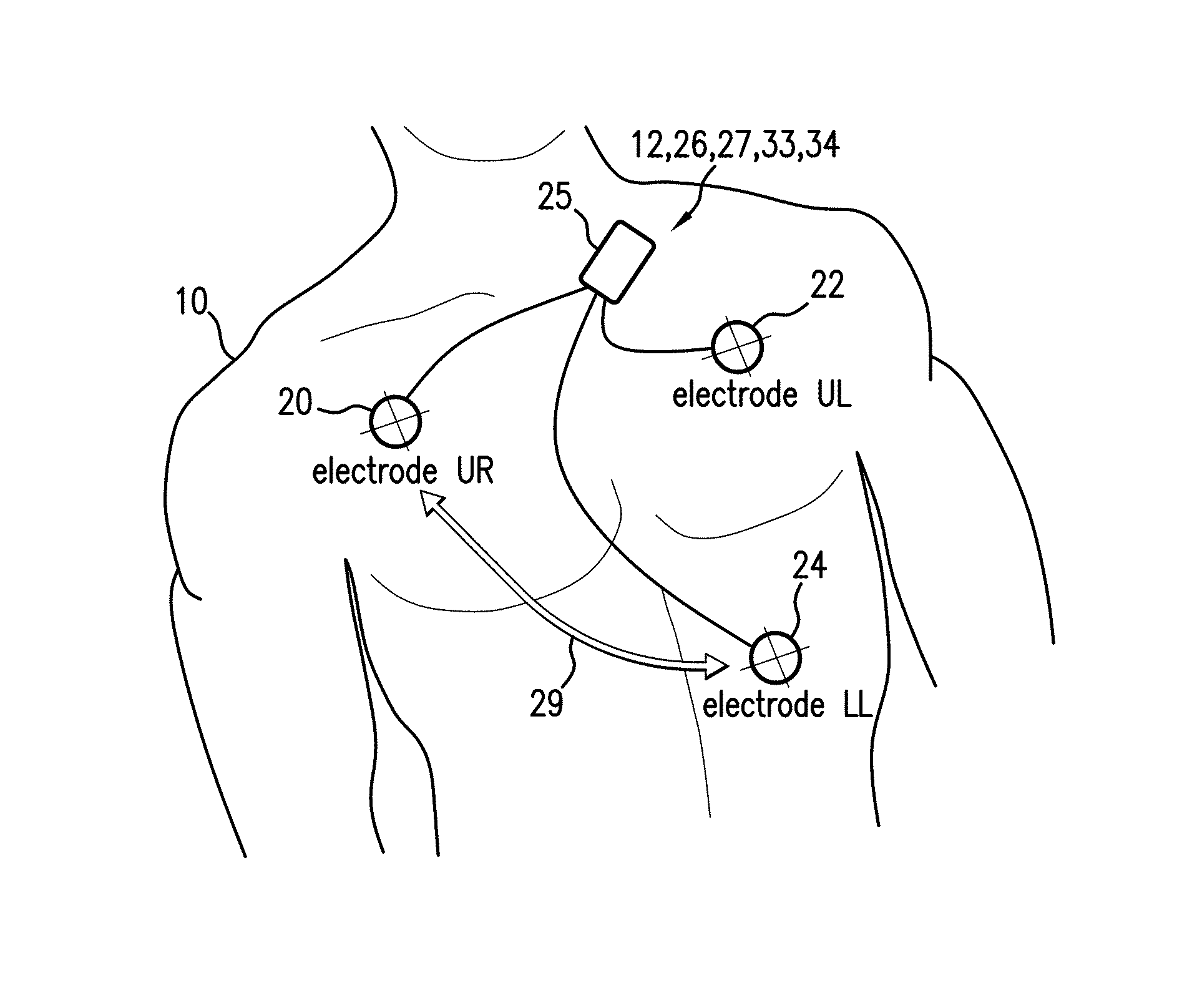 Body-worn monitor for measuring respiratory rate