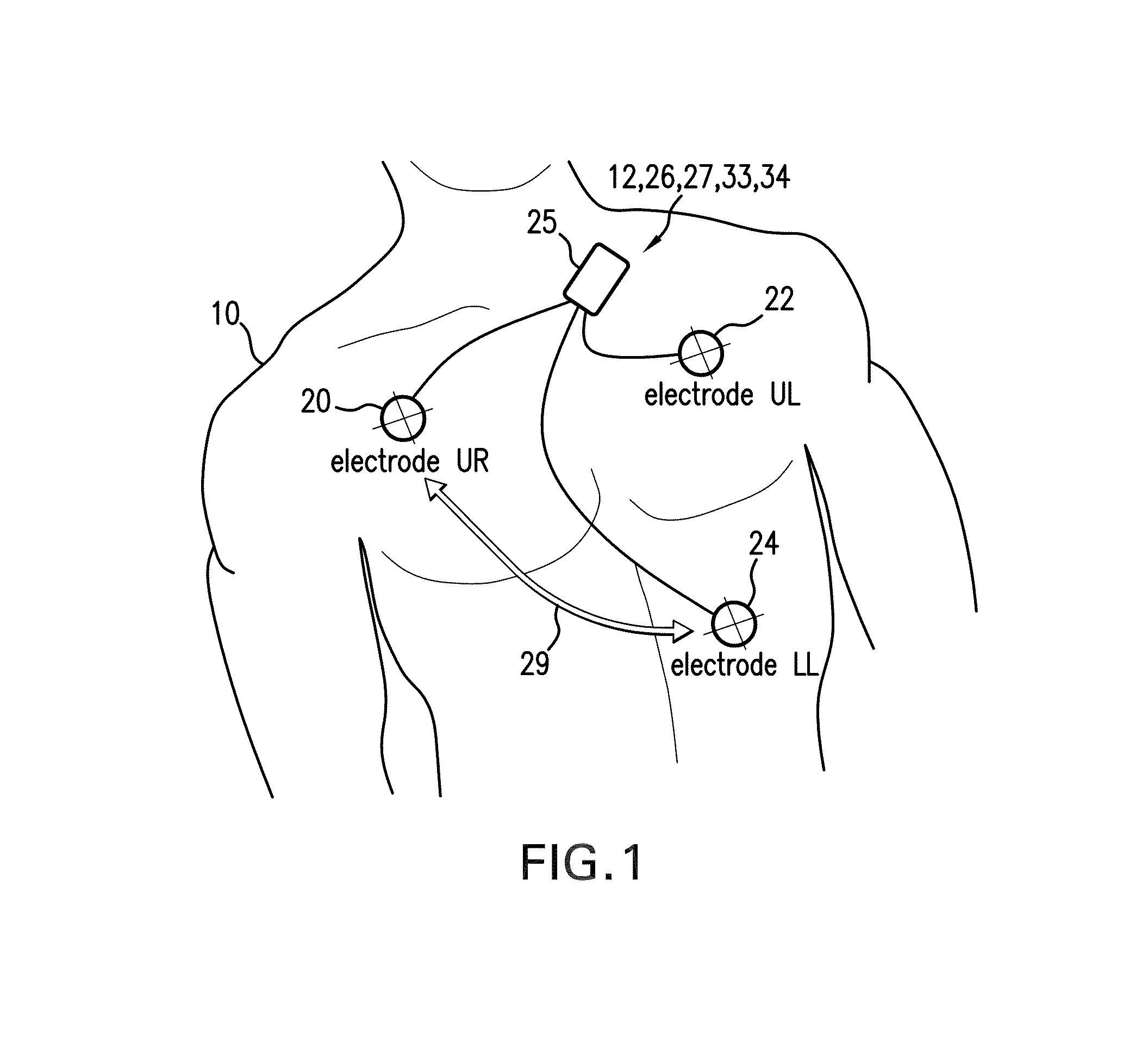 Body-worn monitor for measuring respiratory rate