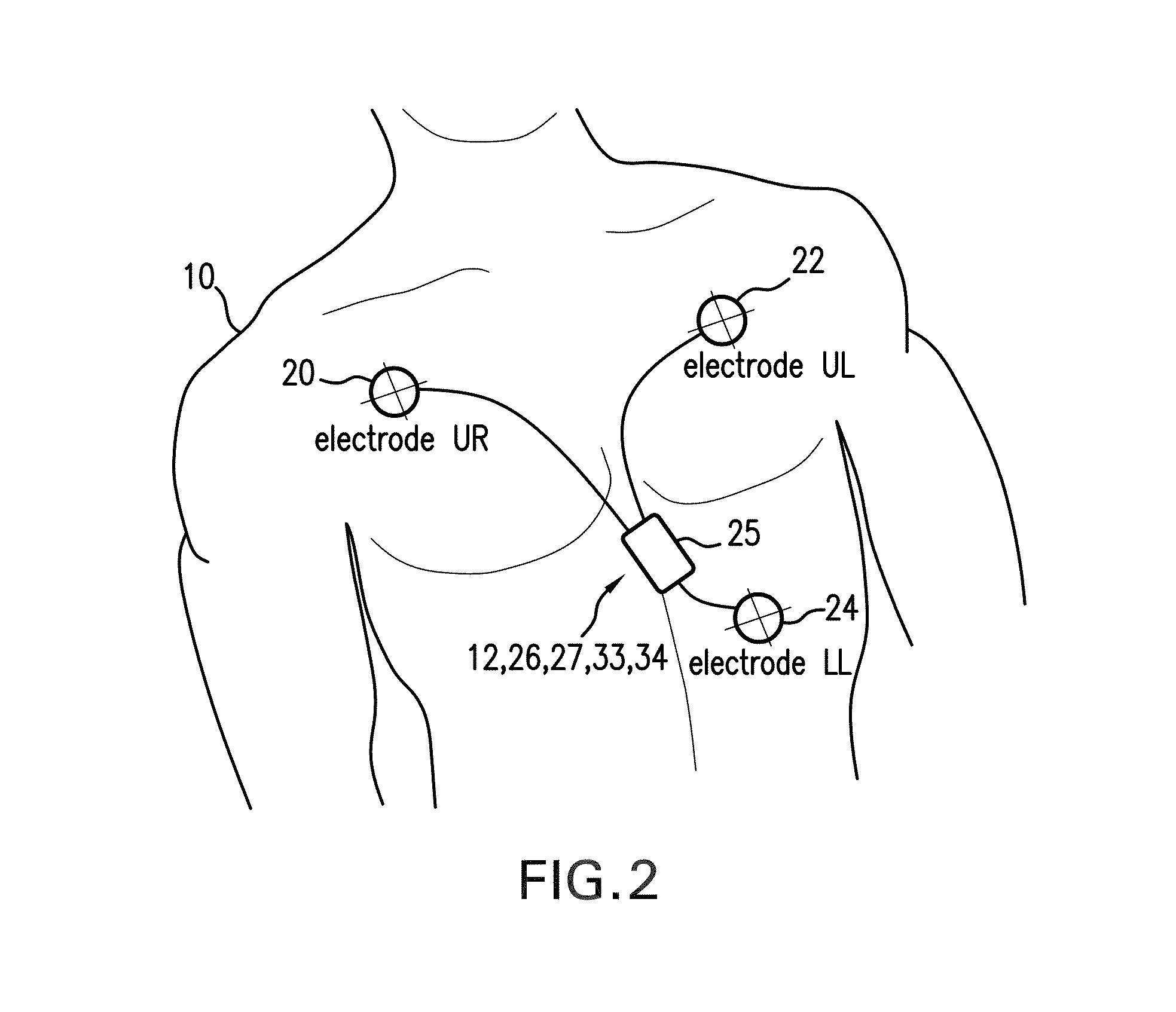 Body-worn monitor for measuring respiratory rate