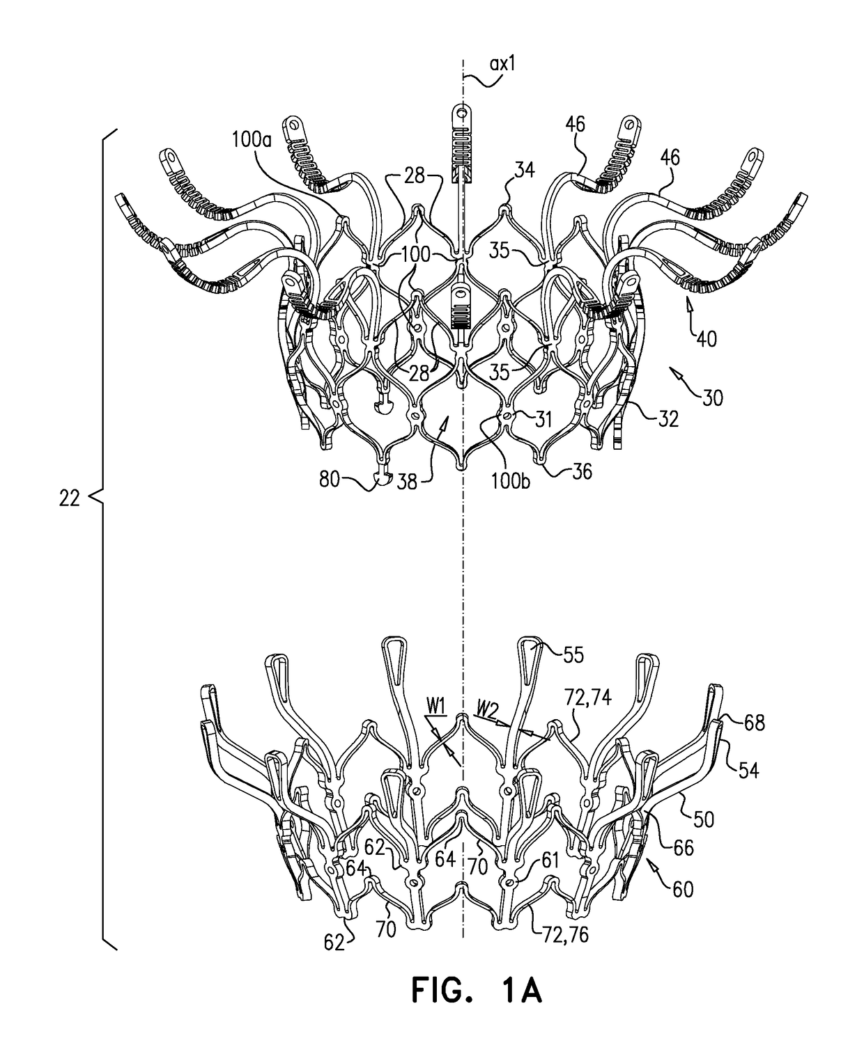 Prosthetic Heart Valve