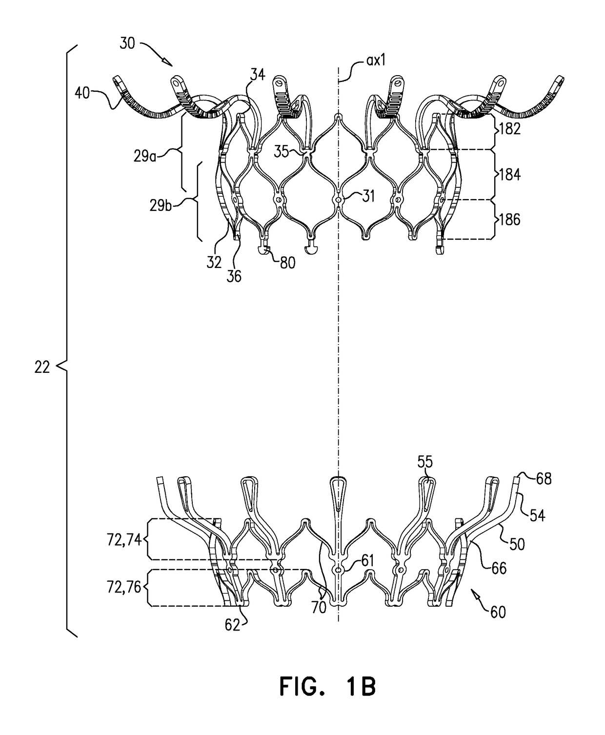 Prosthetic Heart Valve