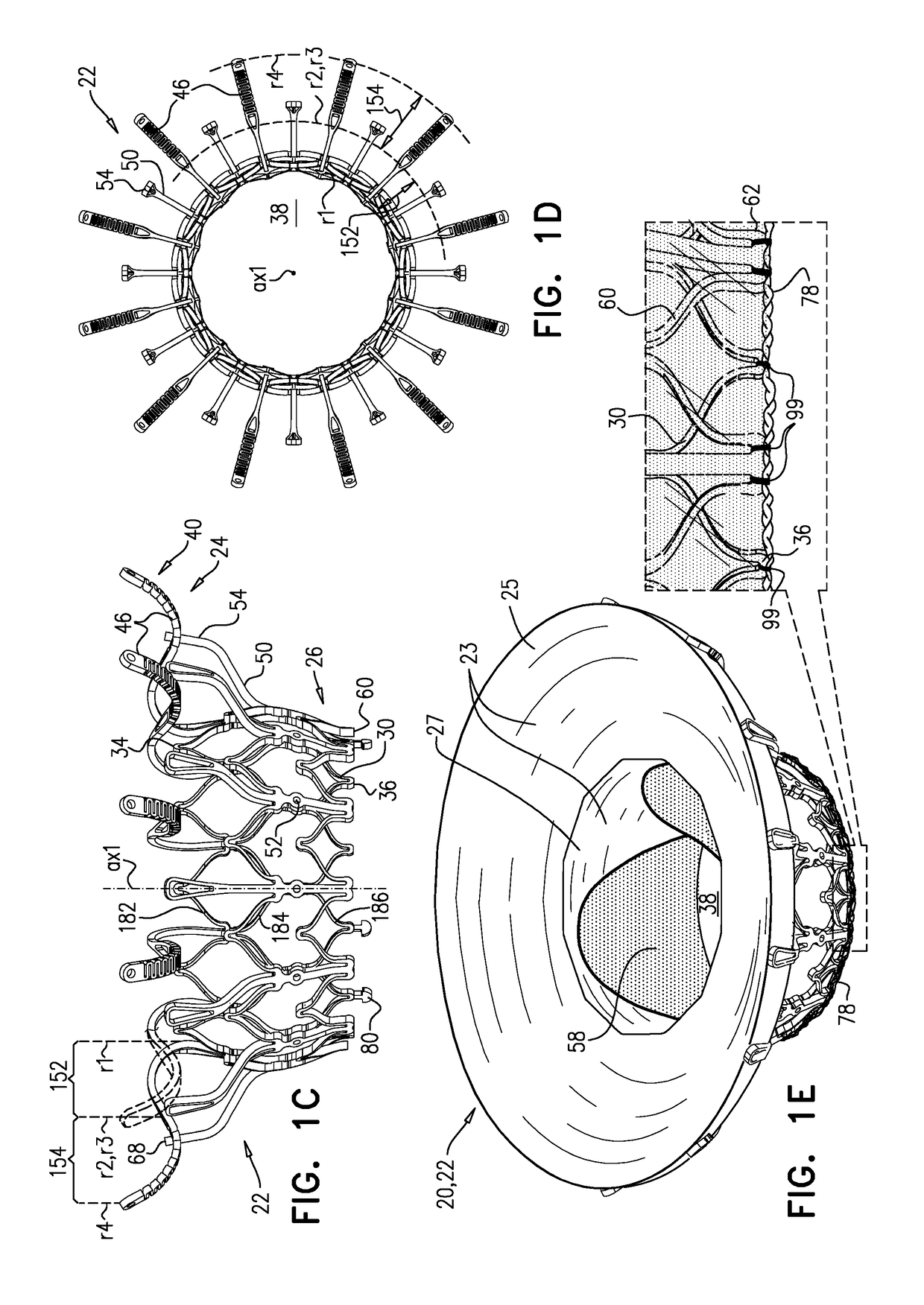 Prosthetic Heart Valve