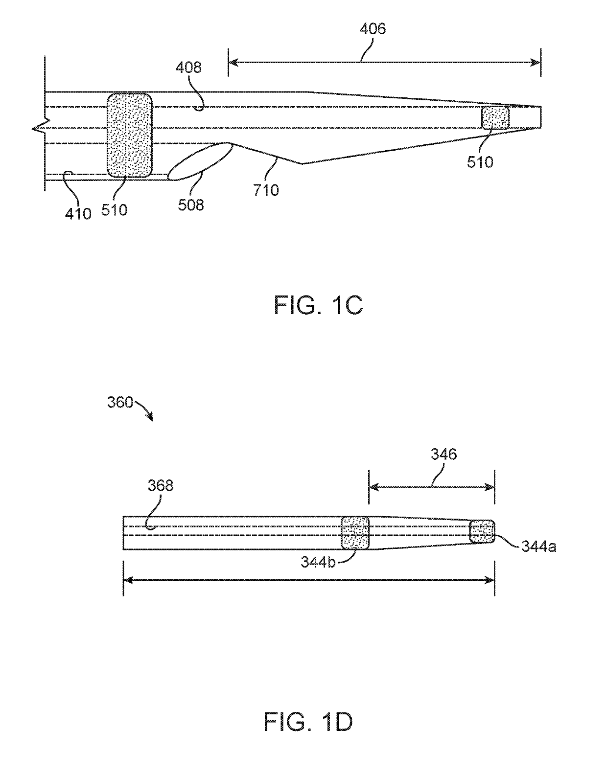 Anchoring delivery system and methods