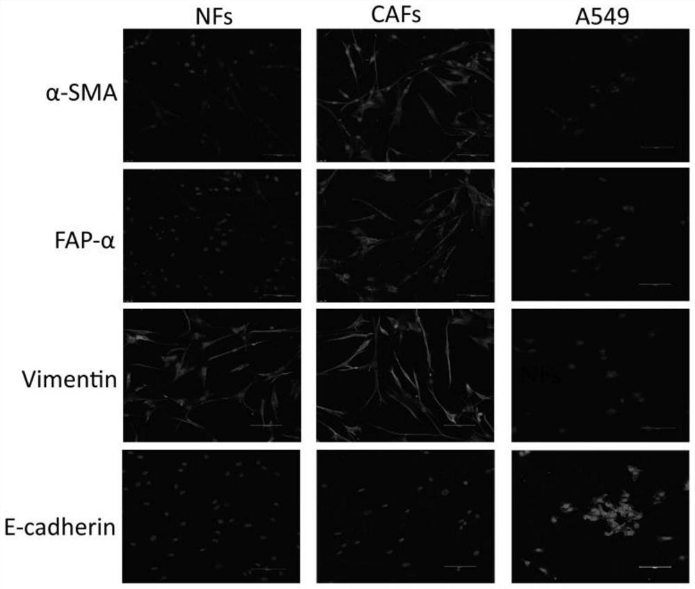 Medicinal use of NRK in lung cancer therapy and prognosis