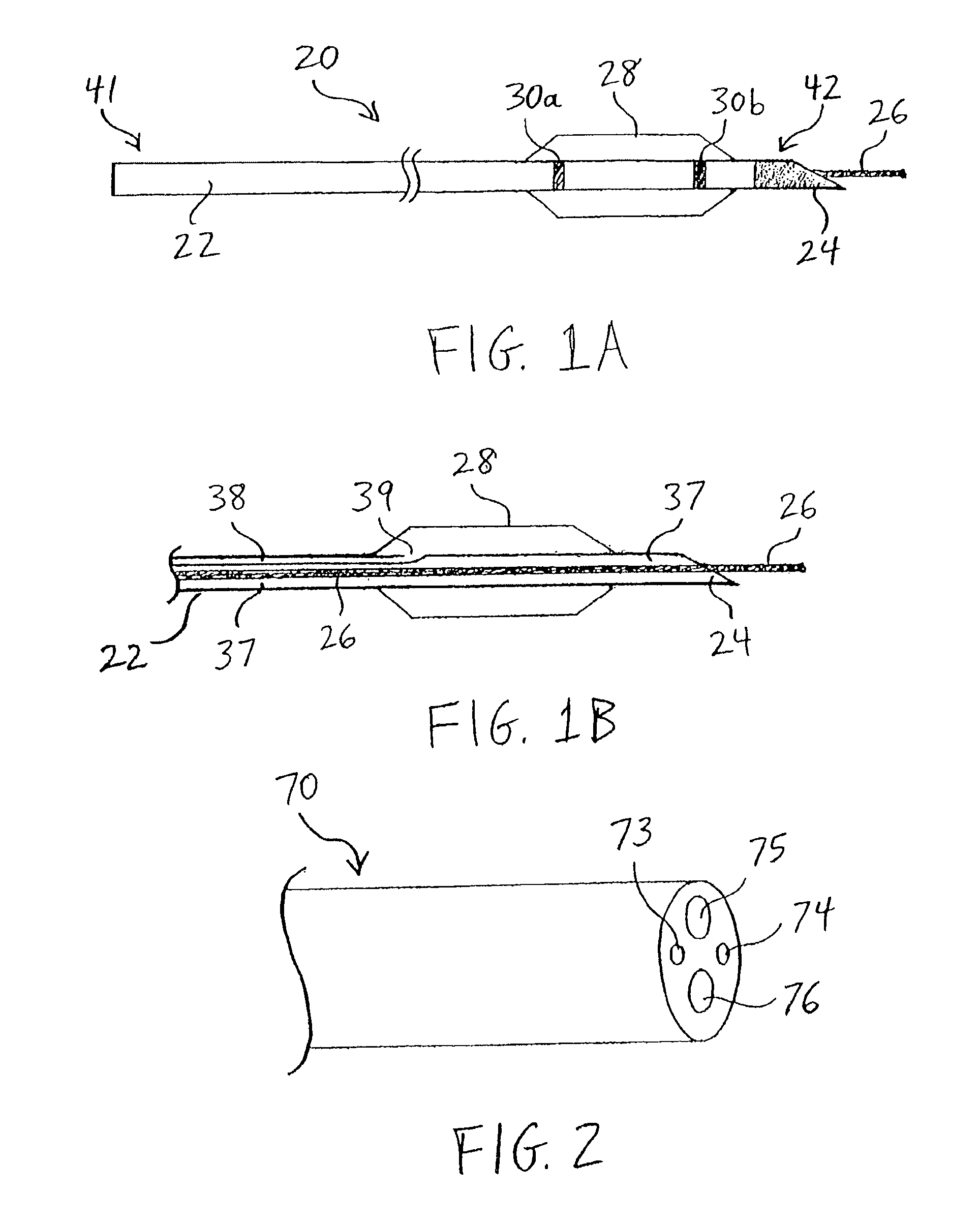 Apparatus and methods for endoscopic resection of tissue