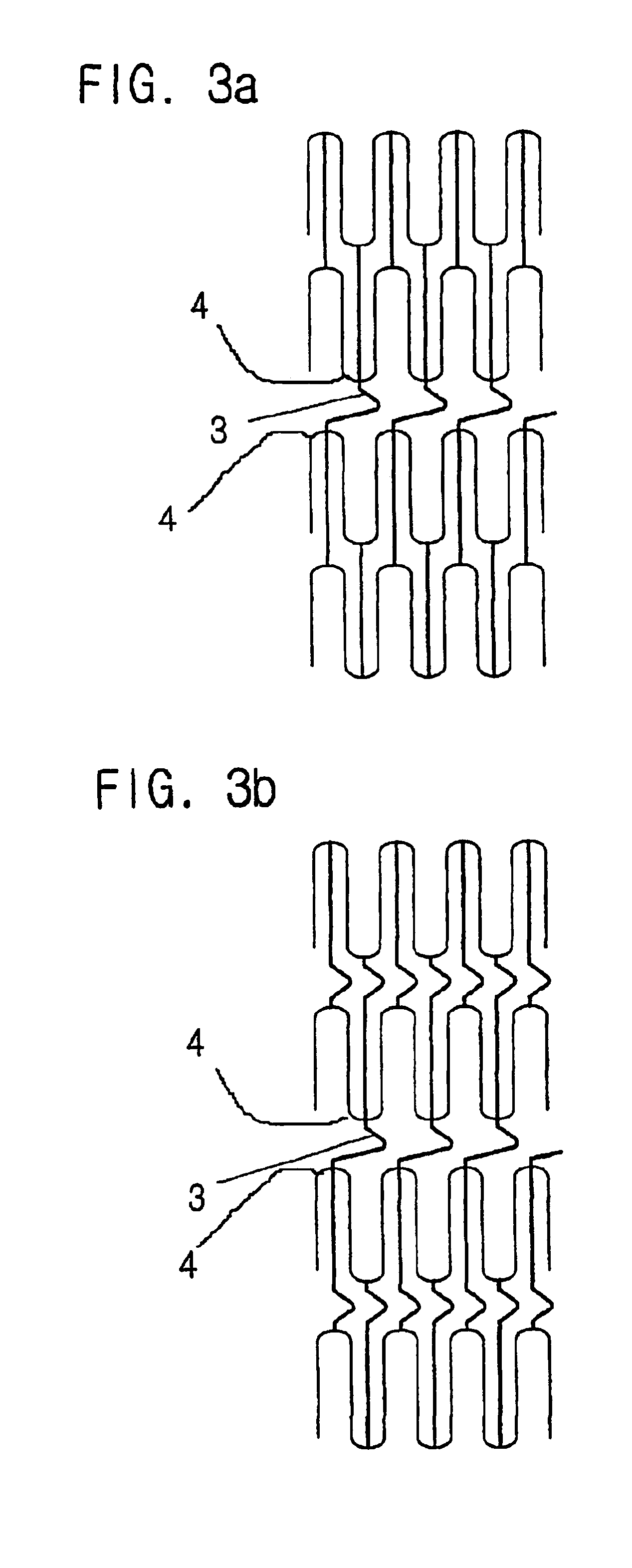 Metal stent for insertion in coronary artery