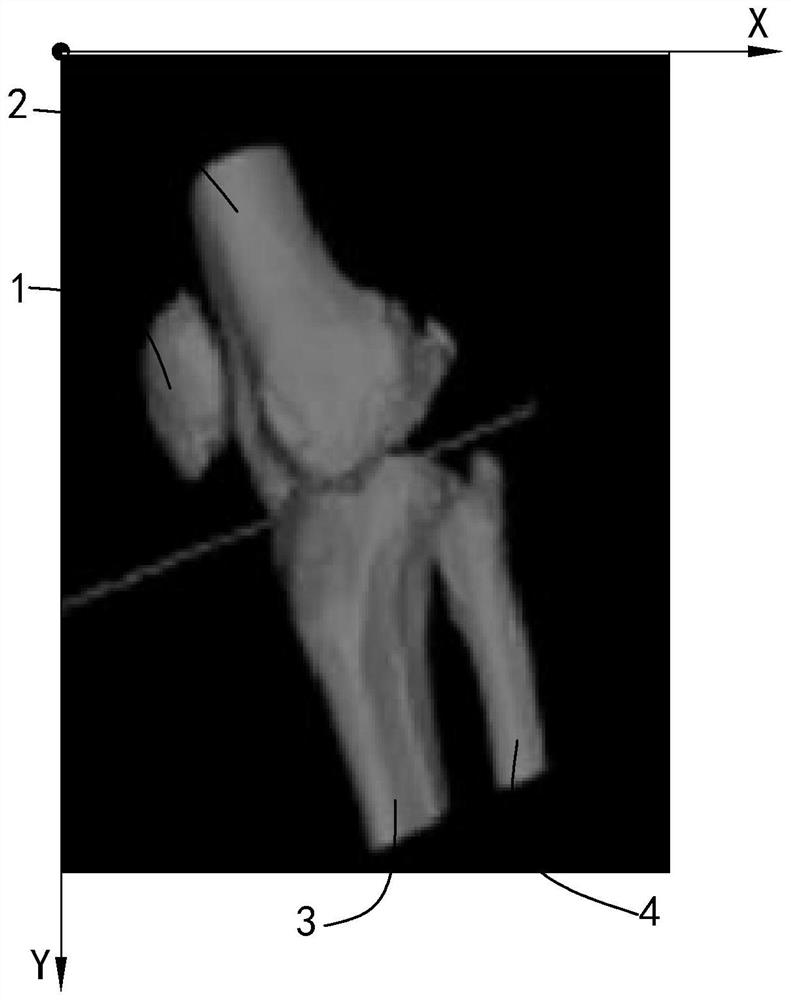 Knee joint CT image automatic segmentation method and device and electronic equipment