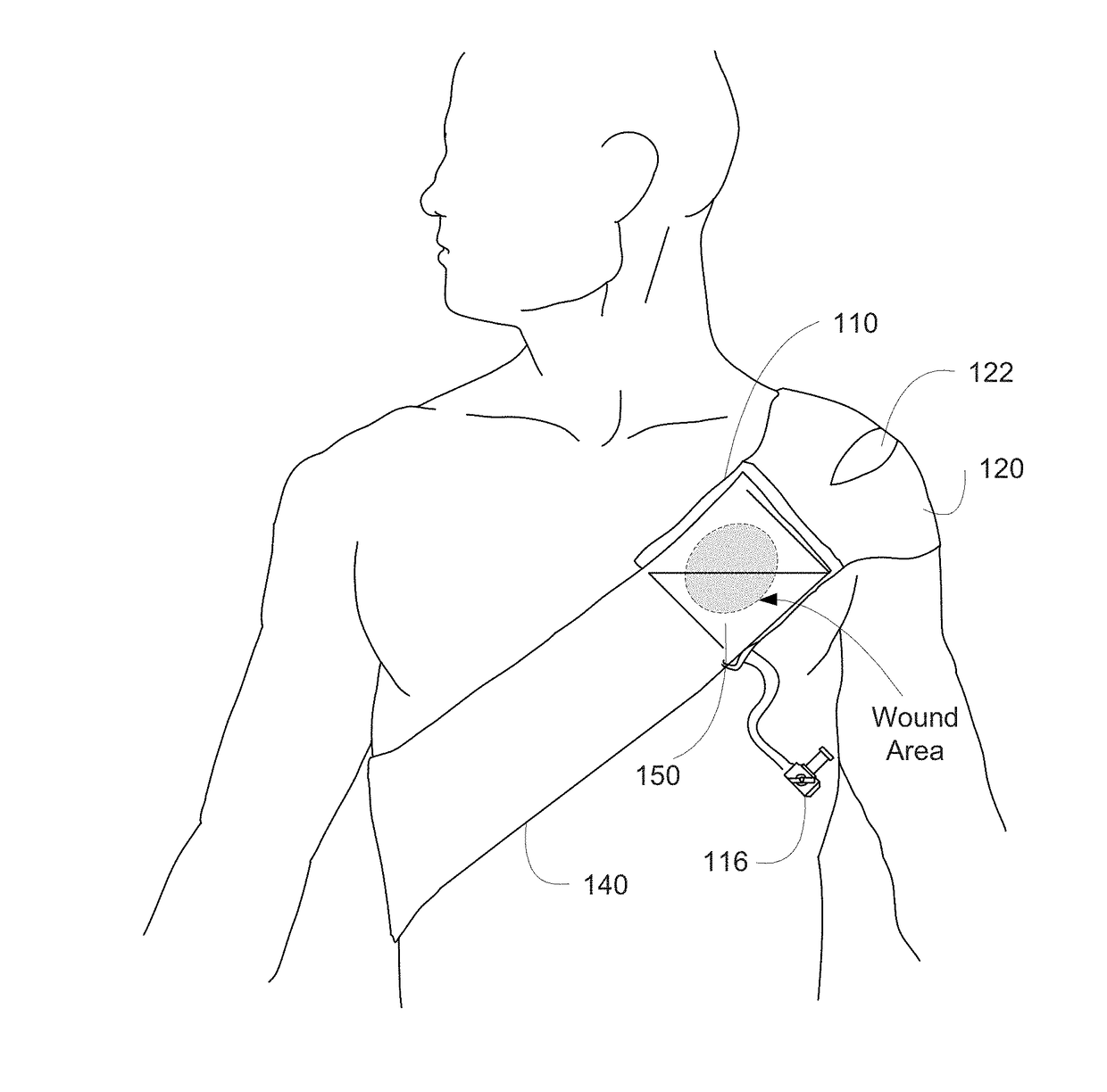 Pressure bandage