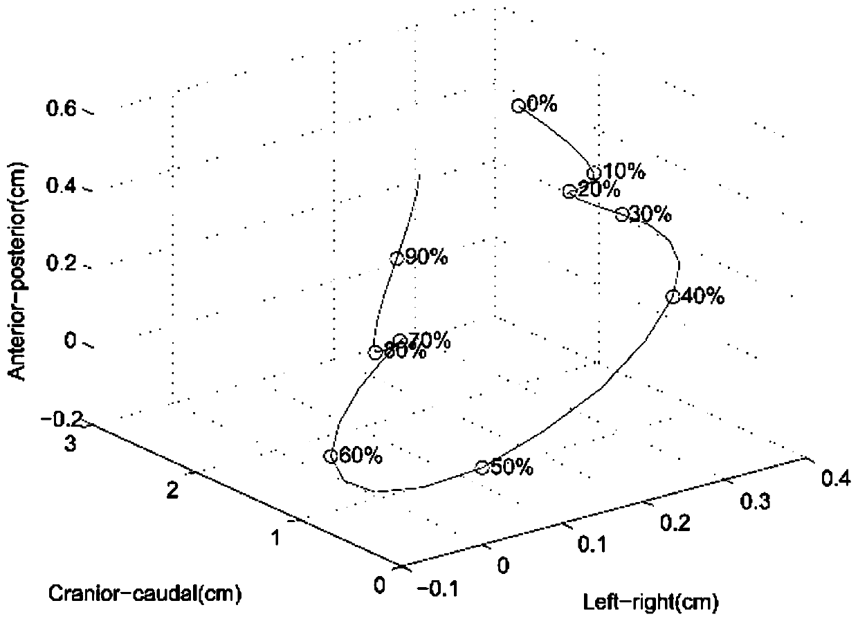 Method, medium and device for reconstructing special image for performing image omics feature extraction based on lung tumor 4DCT image