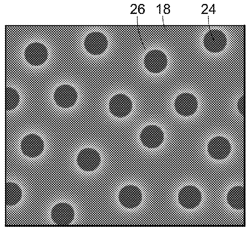 Subthreshold micropulse laser prophylactic treatment for chronic progressive retinal diseases