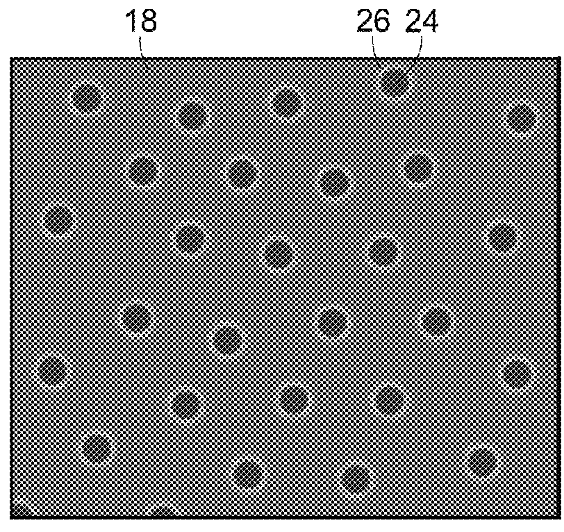 Subthreshold micropulse laser prophylactic treatment for chronic progressive retinal diseases