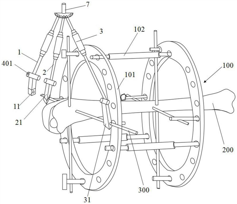 Sighting device of bone penetrating fixing needle