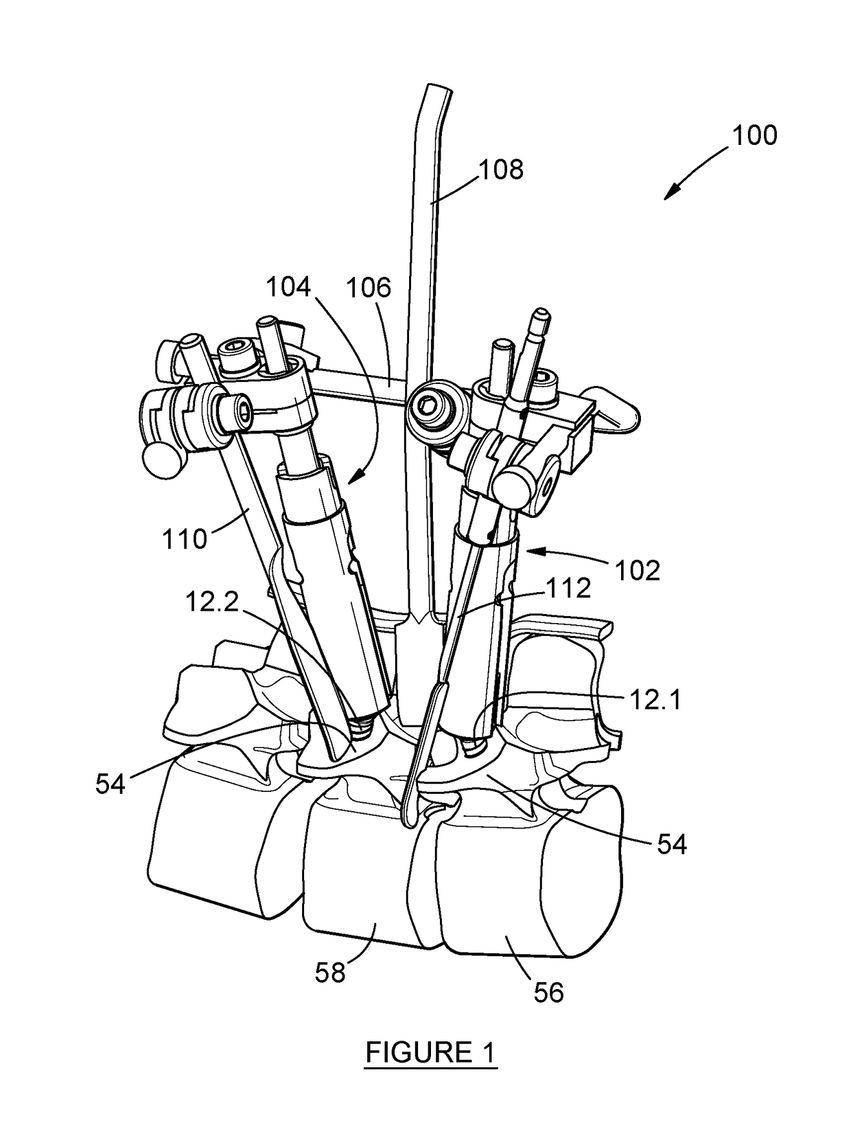 Pedicle mountable retractor system