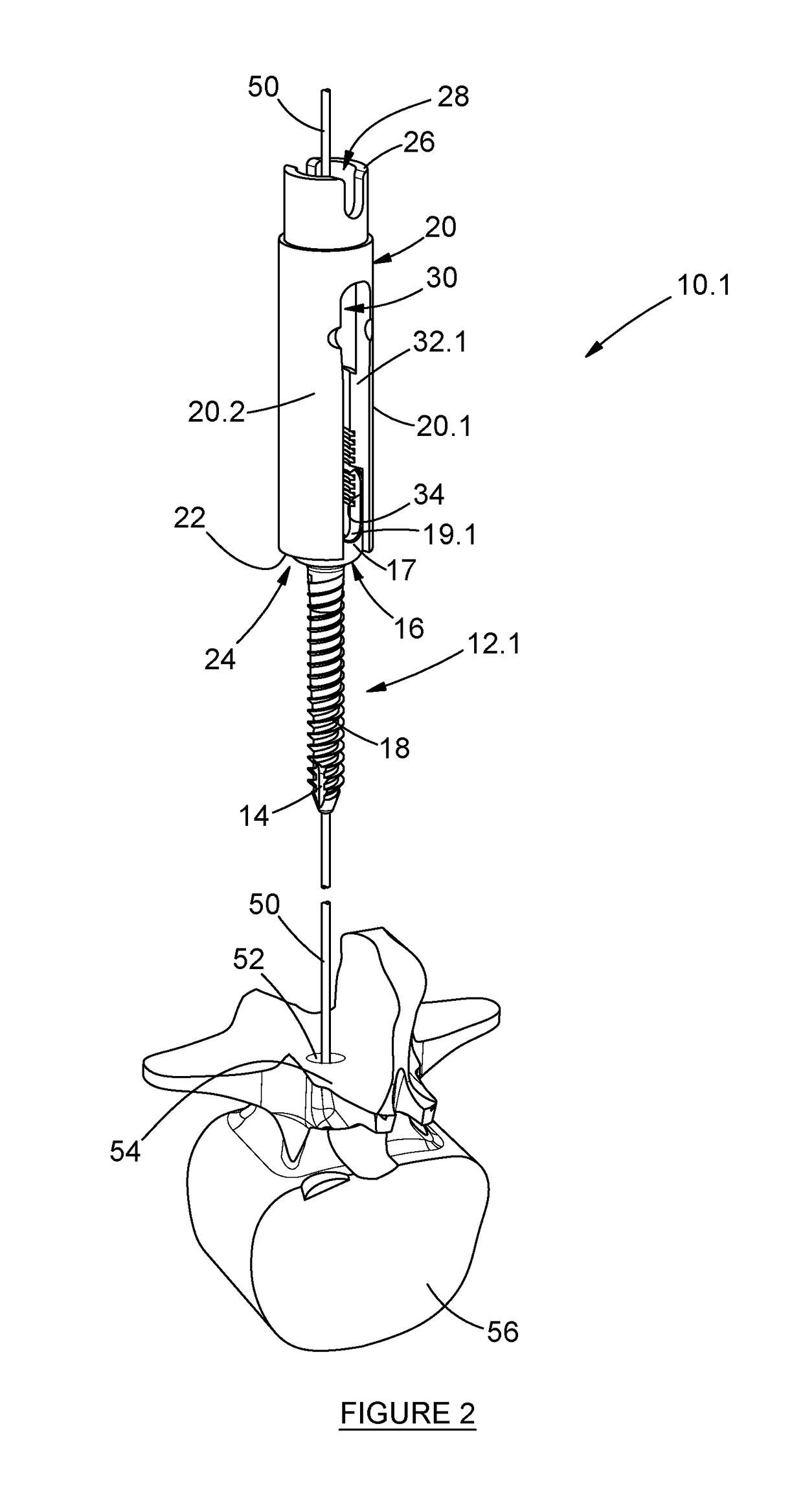 Pedicle mountable retractor system