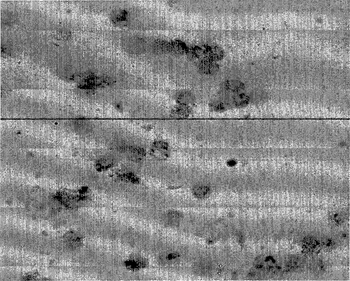 In situ hybridization detection kit for PAX9 gene, and detecting method and use thereof