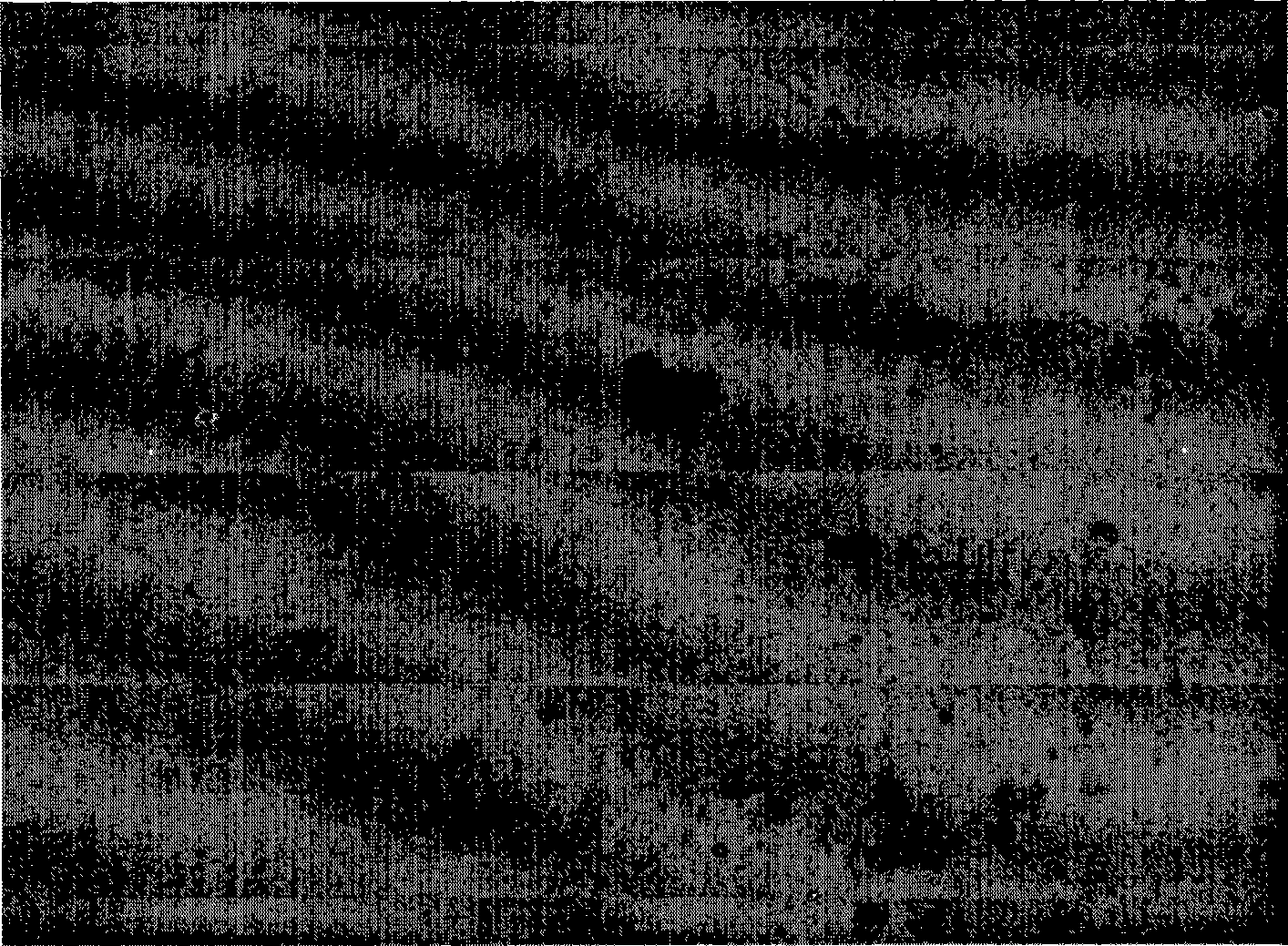 In situ hybridization detection kit for PAX9 gene, and detecting method and use thereof