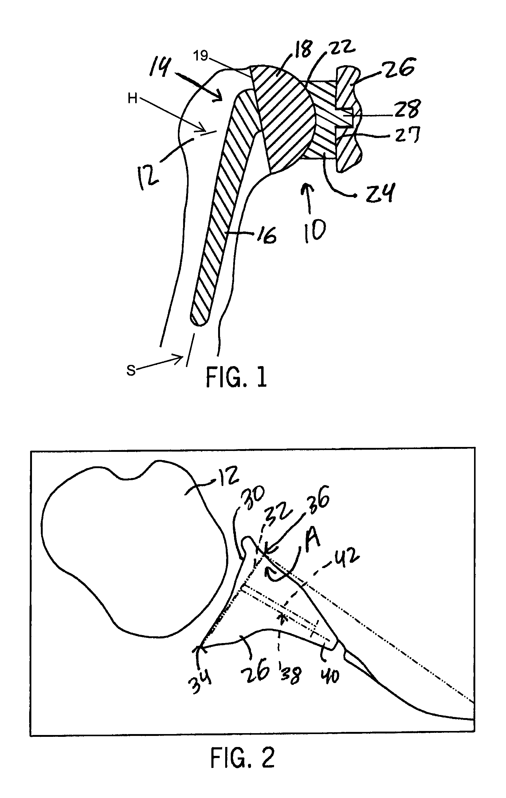 Method for optimization of joint arthroplasty component design