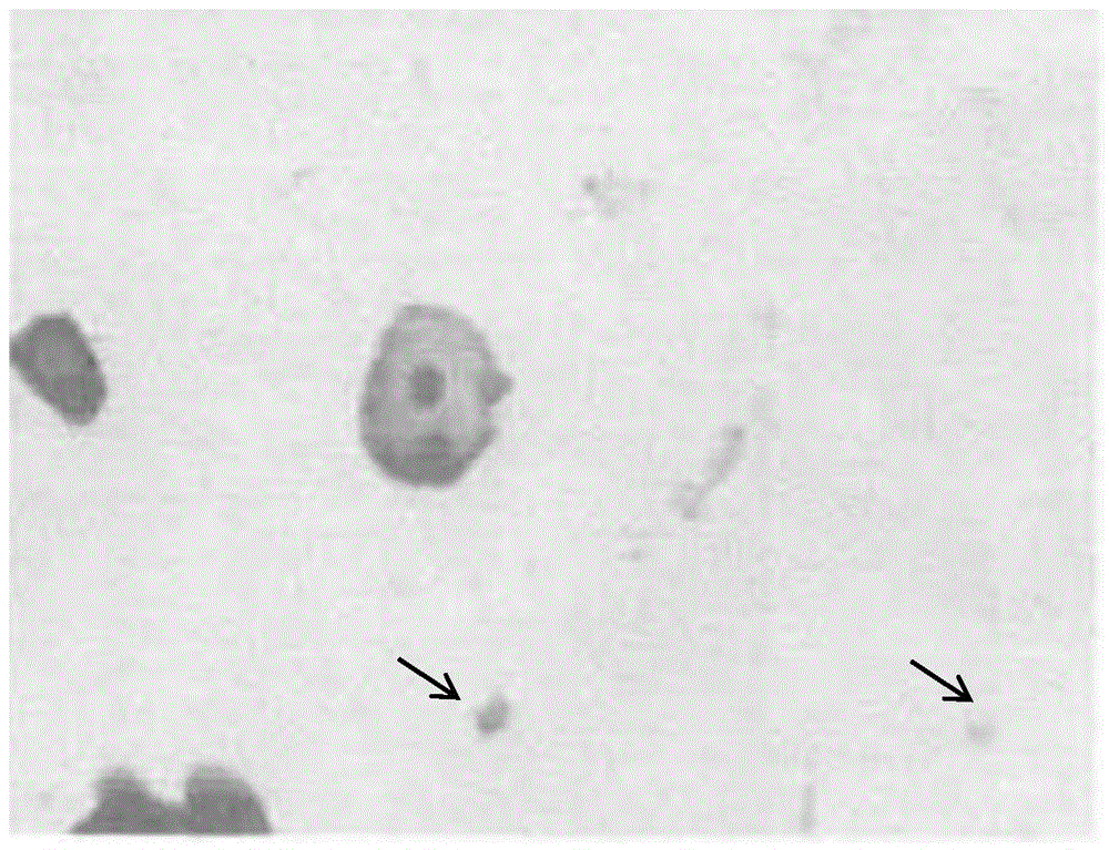 A liquid-based preservation solution for exfoliated cells, its method and kit for making sheets