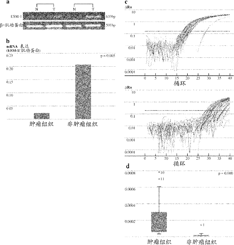 ELISA (enzyme linked immunosorbent assay) kit for detecting endothelial cell specific molecule-1 (ESM-1) of tumour marker