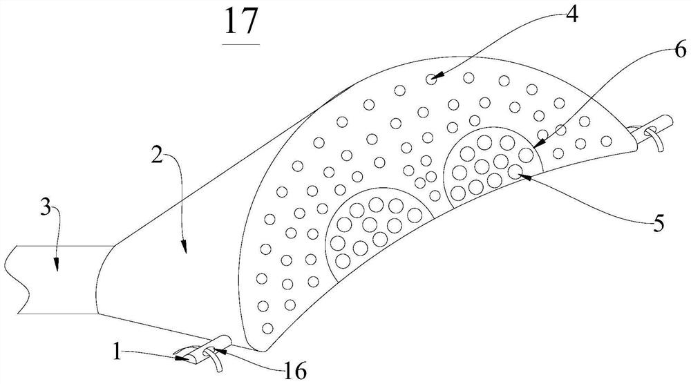 Glaucoma drainage device