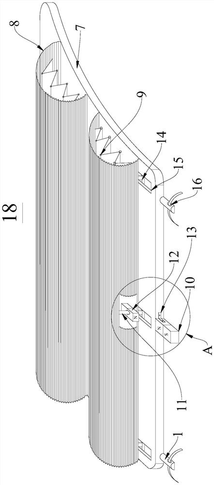 Glaucoma drainage device