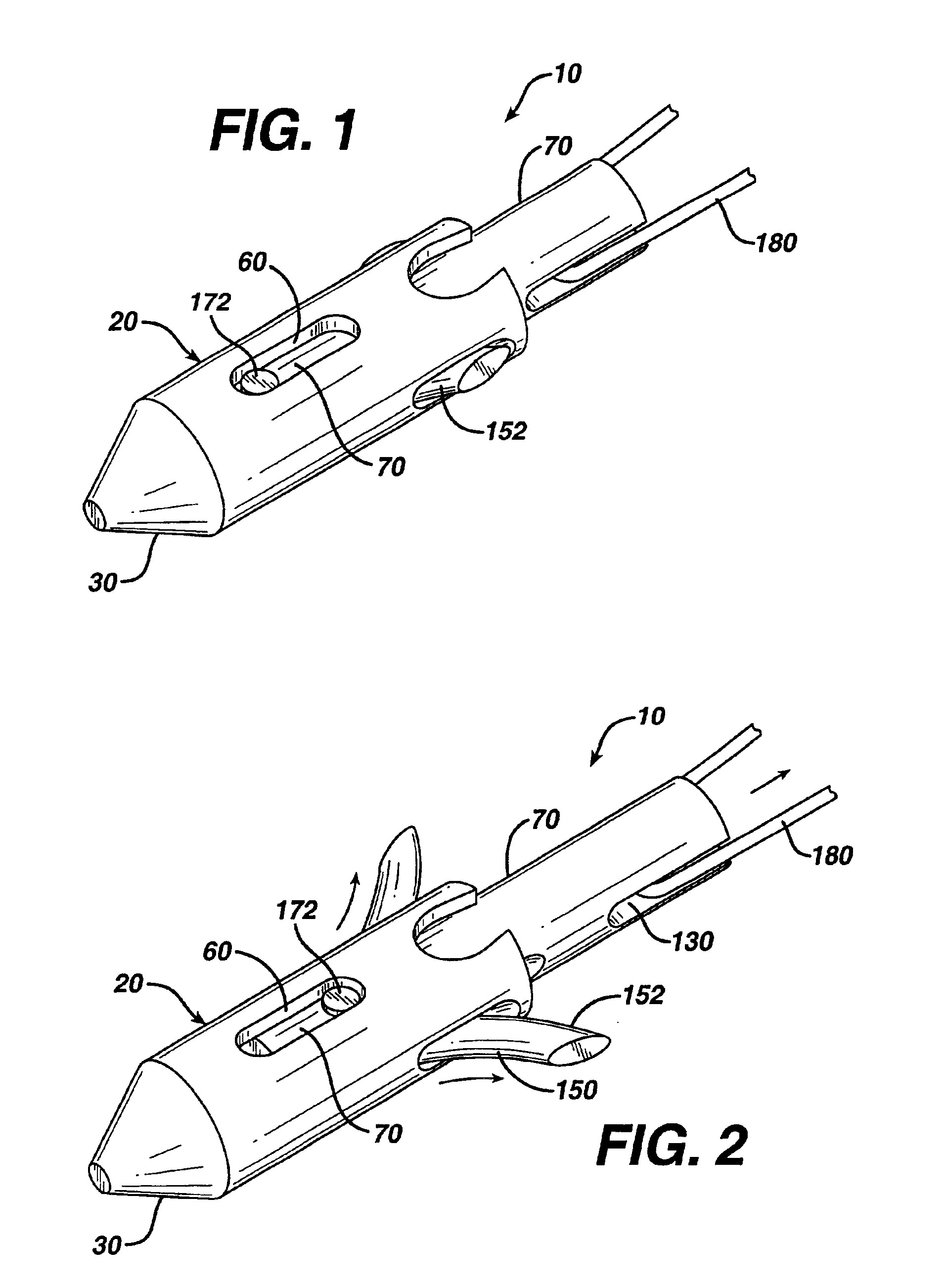 Suture anchor