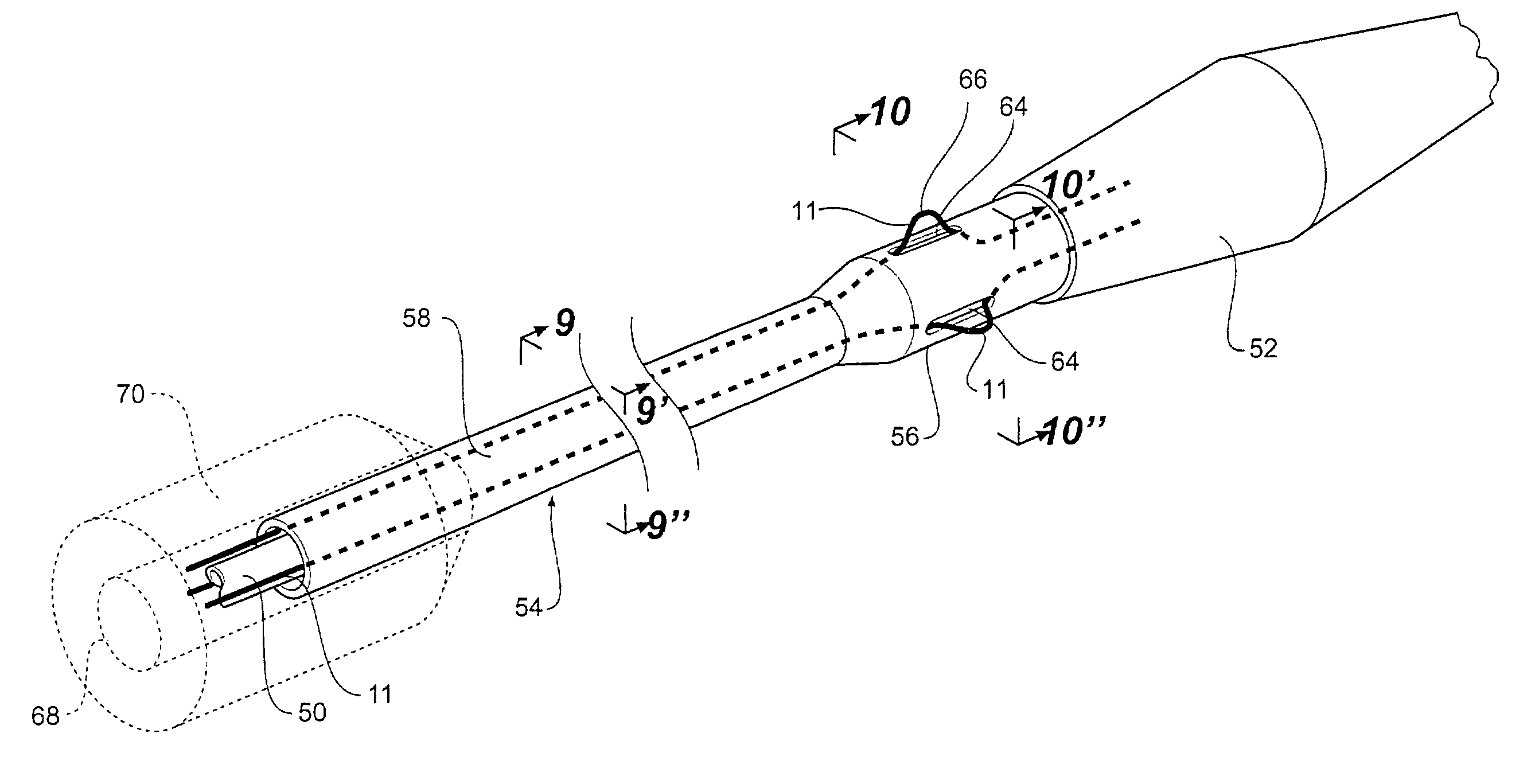 Trigger wire system