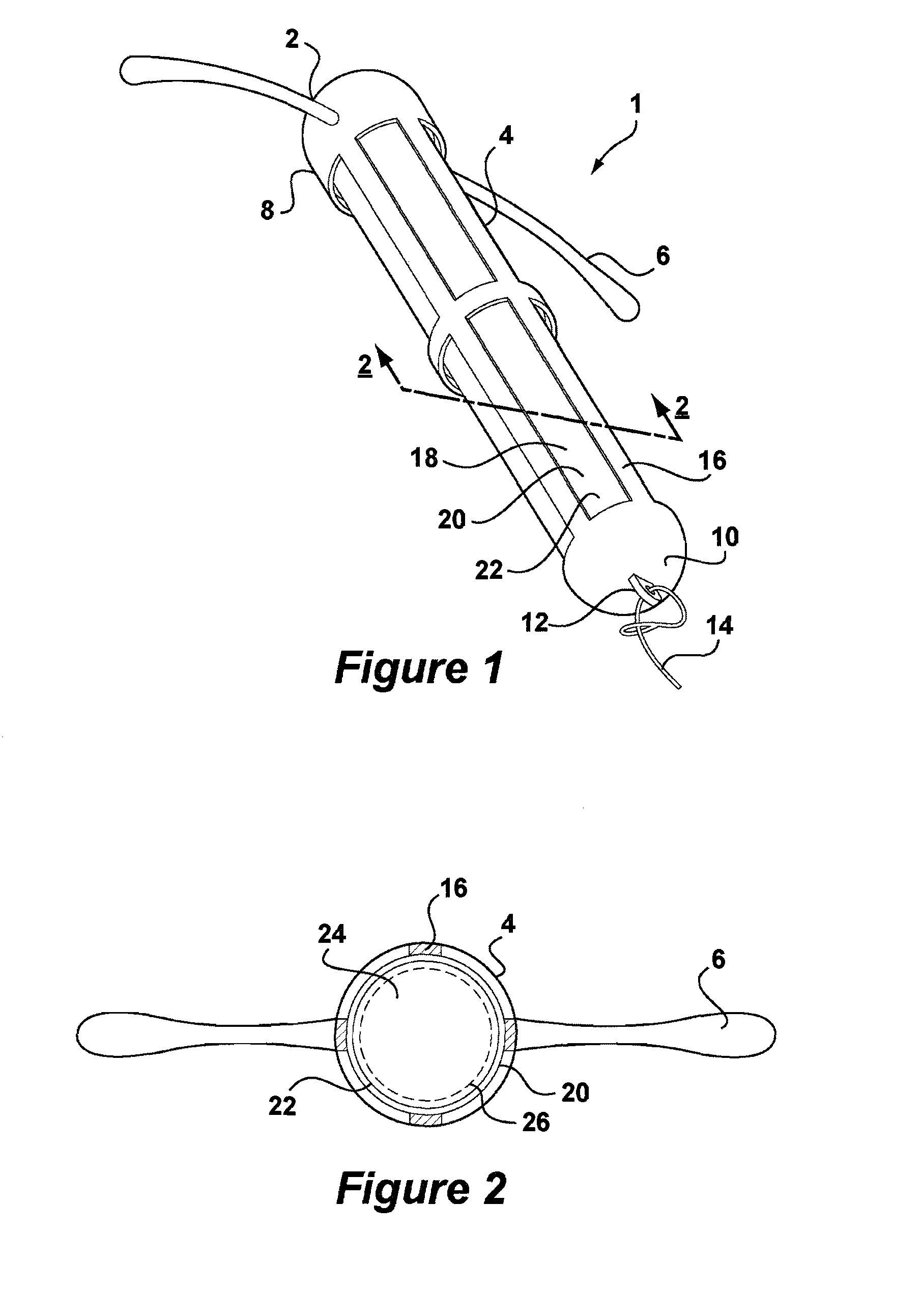 Intrauterine system