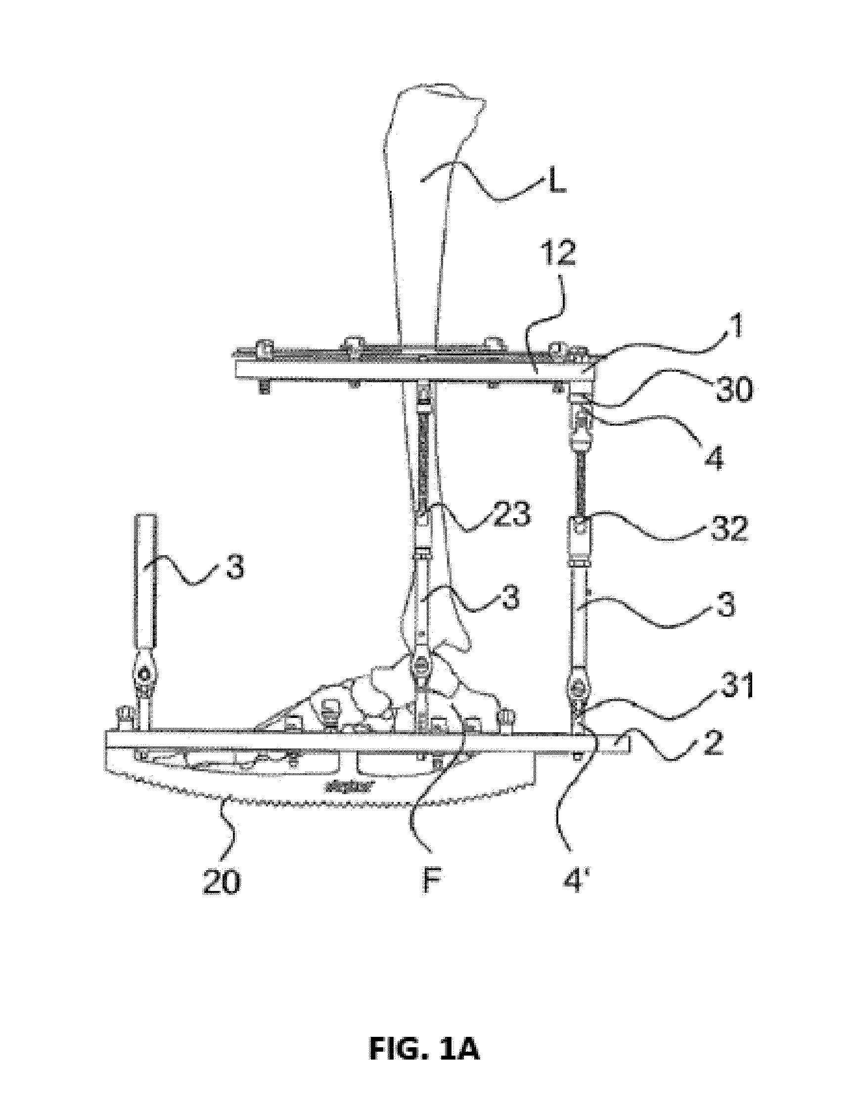 External fixator system