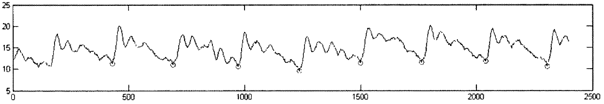 Modification algorithm-based method for extracting simplex-wave feature points of intracranial pressure signals