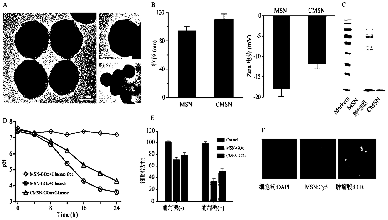 Tumor cell membrane coated nanometer material, method for preparing same and application of tumor cell membrane coated nanometer material