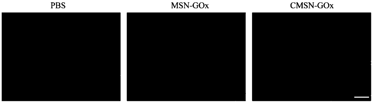 Tumor cell membrane coated nanometer material, method for preparing same and application of tumor cell membrane coated nanometer material