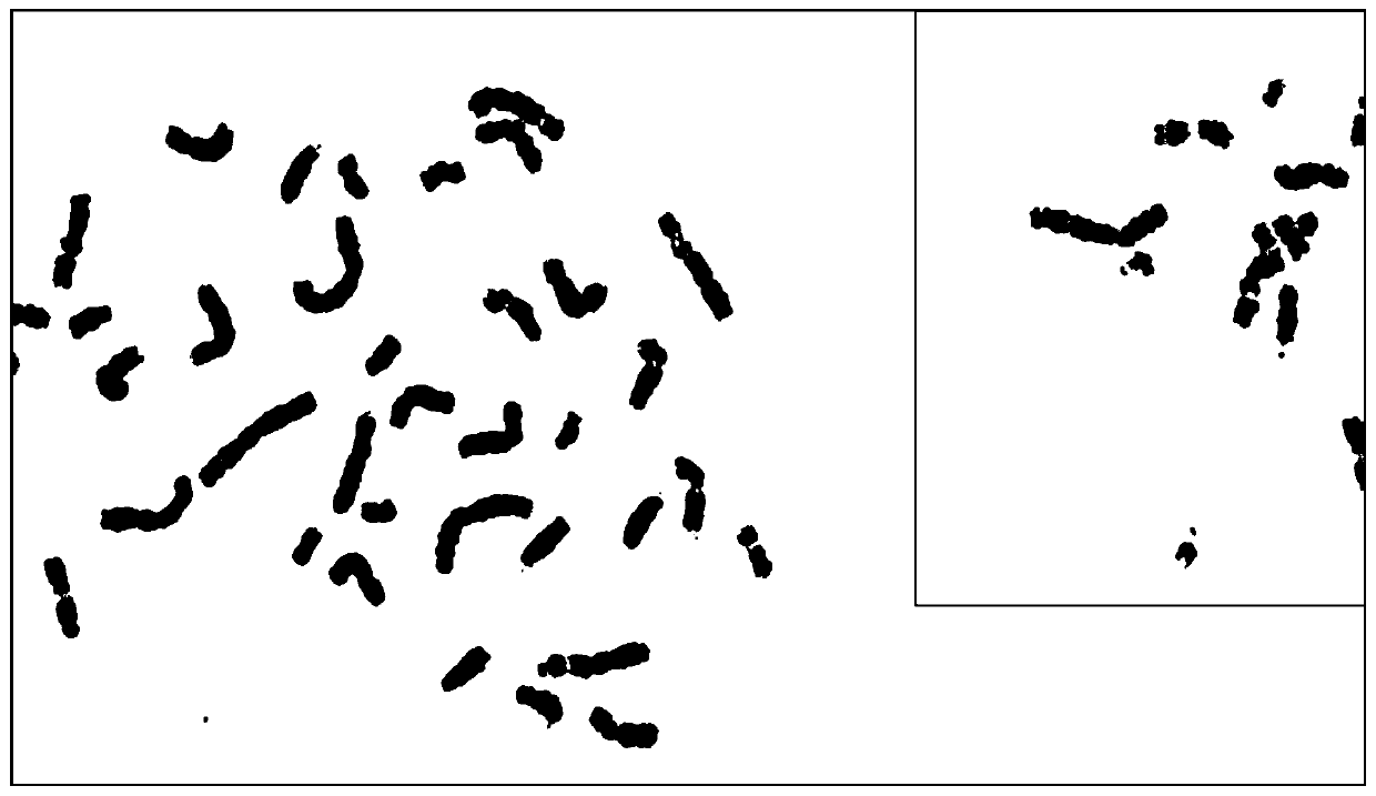 Manufacturing method for high-resolution peripheral blood G band