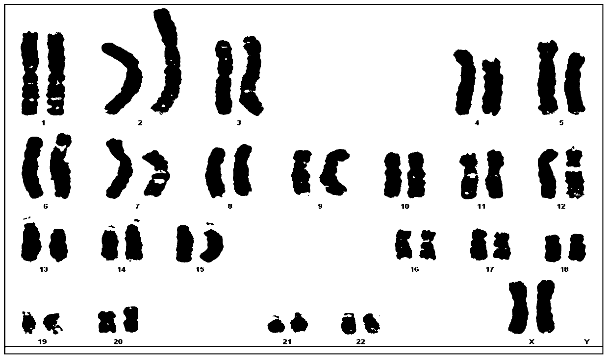 Manufacturing method for high-resolution peripheral blood G band