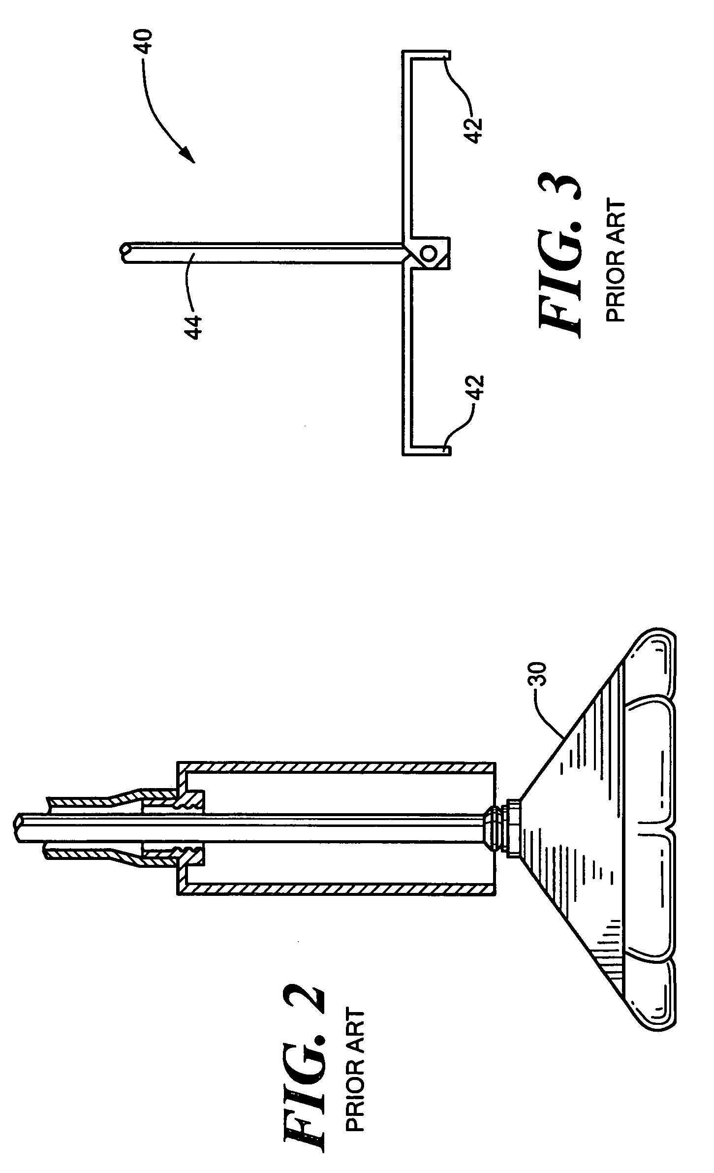 Endovascular tissue removal device