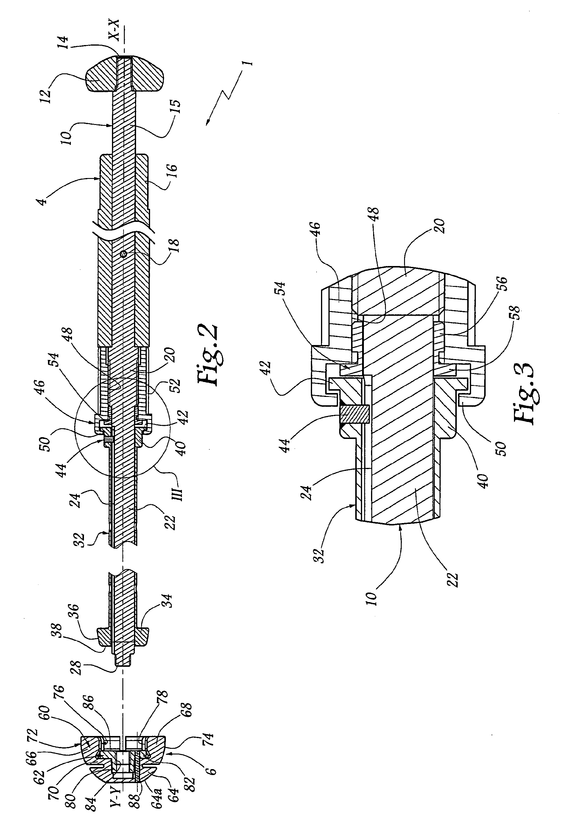 Ancillary tool and method for positioning a prosthetic acetabulum of a hip prosthesis