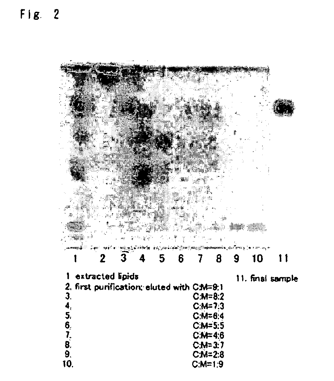 Glyceroglycolipid antigen of Mycoplasma pneumoniae