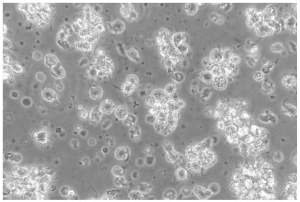 A method for the isolation and primary culture of grass carp dendritic cells